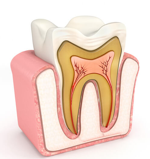 root canal therapy