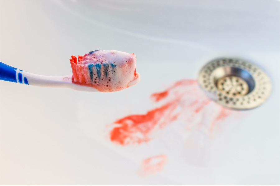A bloody toothbrush over a sink with blood from bleeding gums affected by gum disease